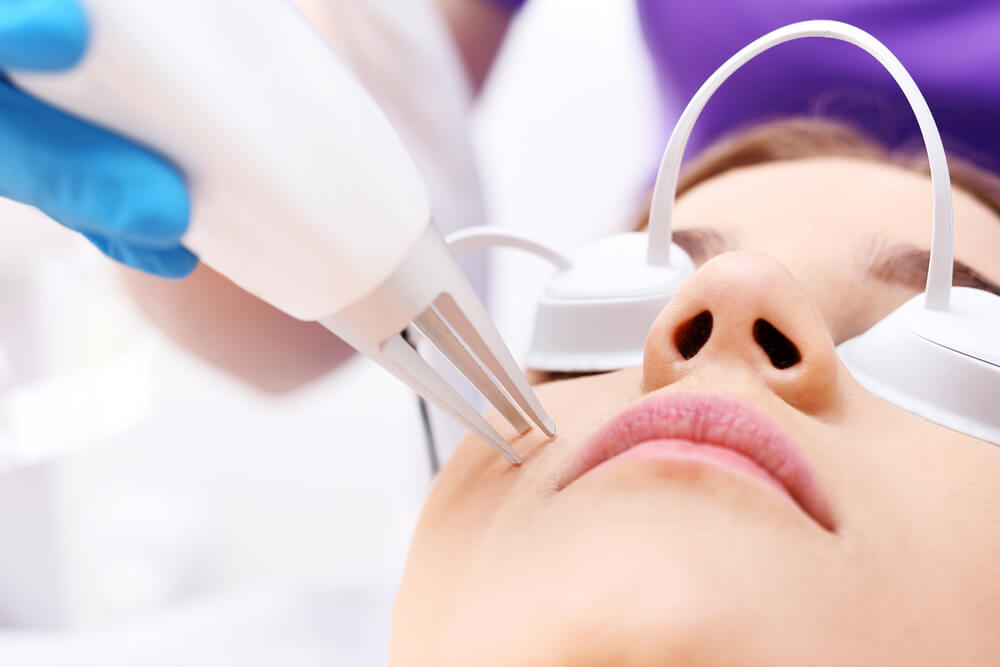 Fade Acne Scars With Laser Scar Removal in Philadelphia